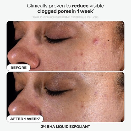 Paula’s Choice Iconic Trio Kit - Travel Size 2% BHA Exfoliant, SPF 50 Moisturizer & Peptide Lip Balm