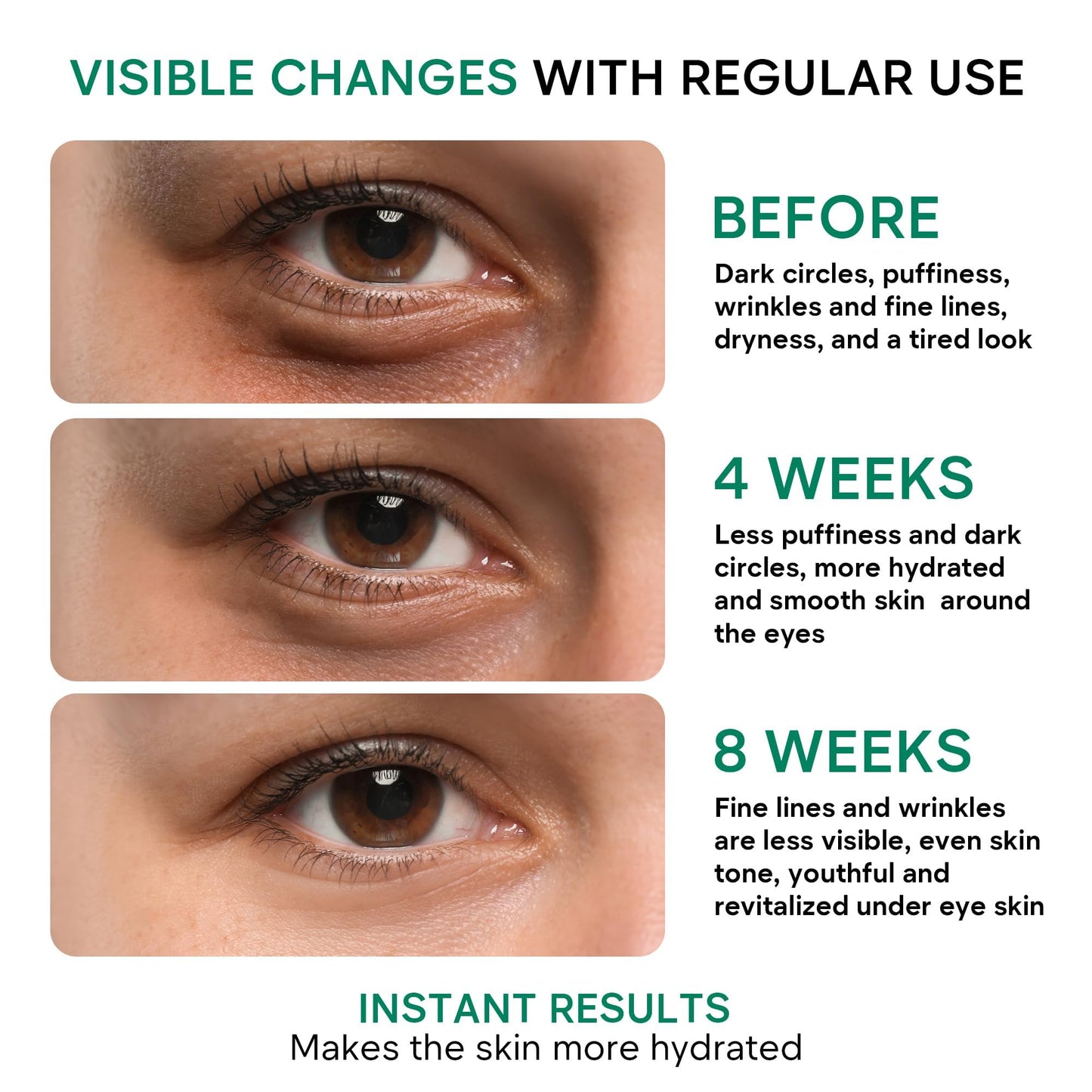 REMEDIAL PAX Eye Cream for Dark Circles and Puffiness, Bags Under Eyes Treatment, Anti-Aging Collagen Eye Cream for Wrinkles, Day & Night Caffeine Eye Cream with Niacinamide Dimethicone