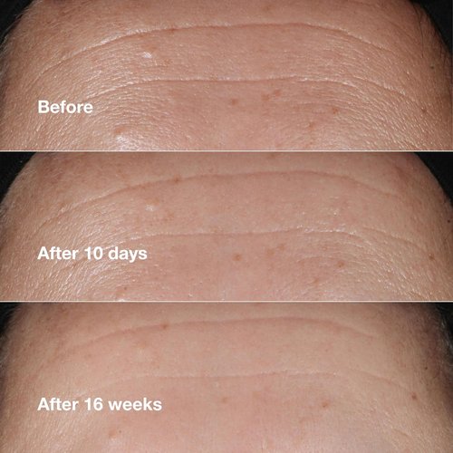 Clinique Smart Clinical Repair Anti-Aging Face Serum - Hydrating with Hyaluronic Acid & Peptides | All Skin Types