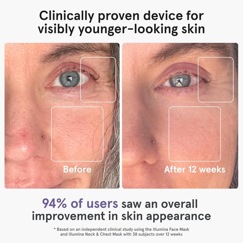 iRestore LED Face Mask - Red Light Therapy for Youthful Skin | 360 LEDs for Wrinkles & Dark Spots