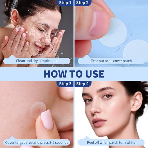 Daolyo Pimple Patches for Face, 4 Size 360 Counts Hydrocolloid Acne Patches for Covering Zits and Blemishes, Spot Stickers with Salicylic Acid, Tea Tree Oil & Calendula Oil, Mini Package