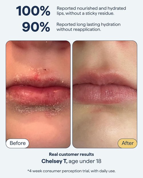 Dr. Shah Lip Balm Ointment - All-In-One Hydrating Treatment with Ceramides & Peptides for Dry, Cracked Lips