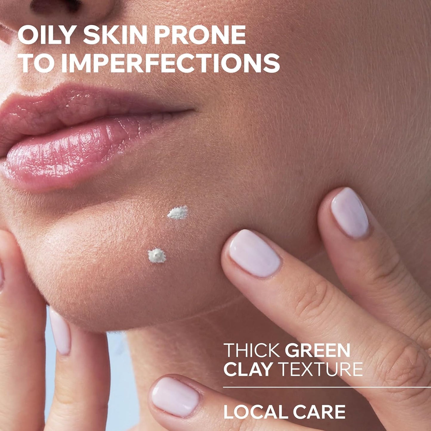 Uriage Hyseac SOS Paste - Tea Tree, Zinc & Green Clay Treatment for Oily Skin | Overnight Imperfection Relief