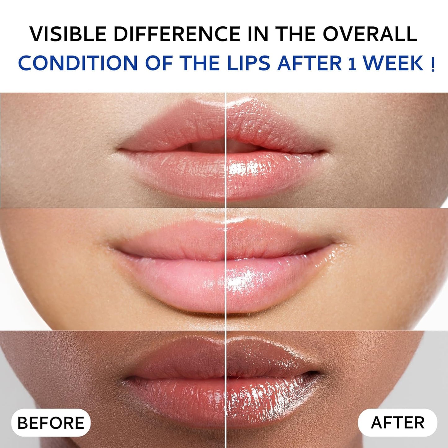 Skiennix Lip Sleeping Mask - Hydrating Overnight Collagen Lip Plumper with Hyaluronic Acid | 20g