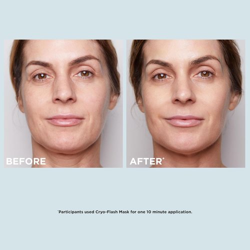 CLARINS Cryo-Flash Face Mask - Visible Lift in 10 Minutes | Minimizes Pores & Boosts Radiance