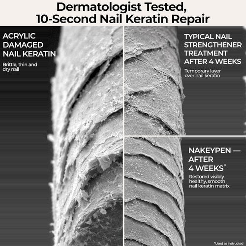 NakeyNails Fast-Absorbing Nail Strengthener | Revitalize Weak, Thin & Post-Acrylic Nails - 45 Day Supply