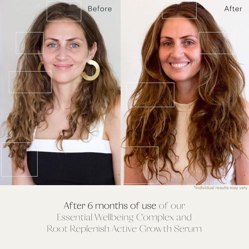 Root Replenish Hair & Scalp Serum - Lightweight Hydrating Formula for Thicker, Fuller Hair | 40 mL