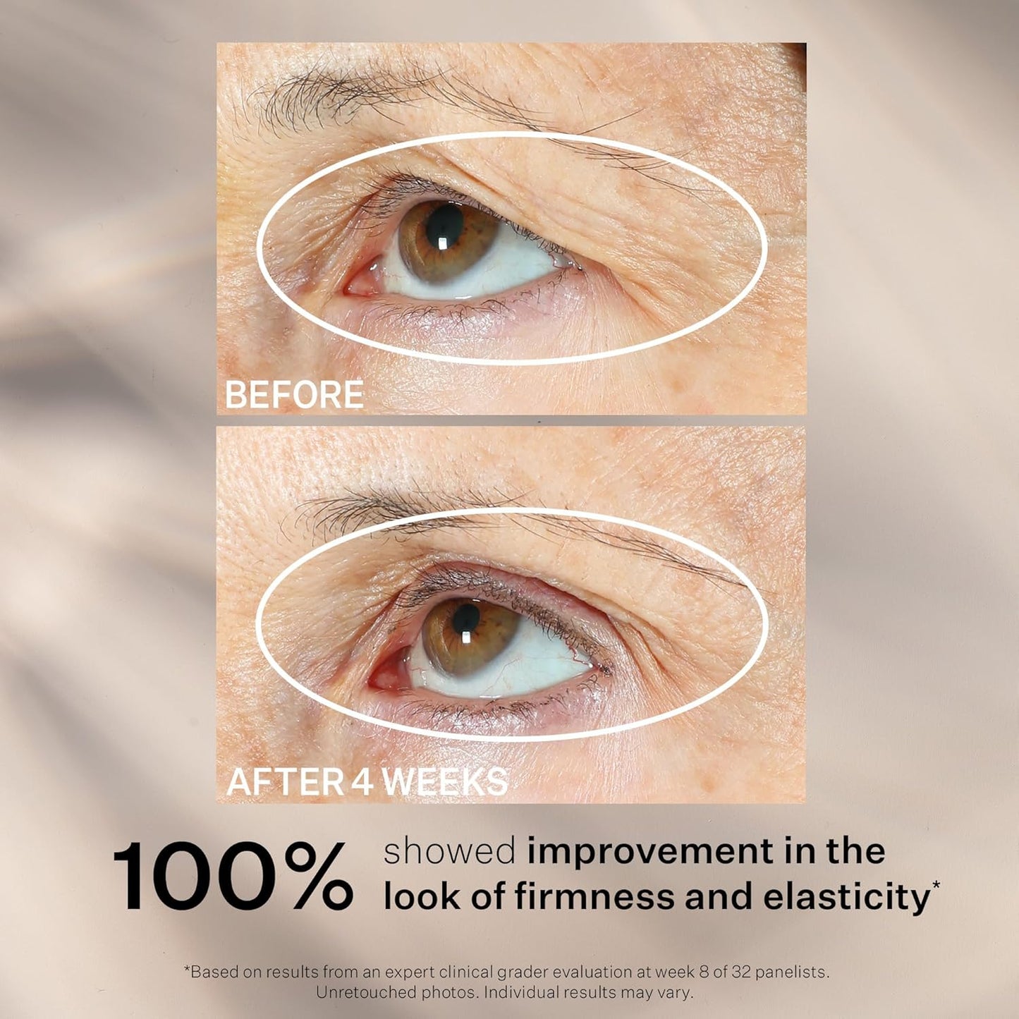 StriVectin Peptight Face Lift Serum - Tightening & Brightening Peptides for Youthful Skin