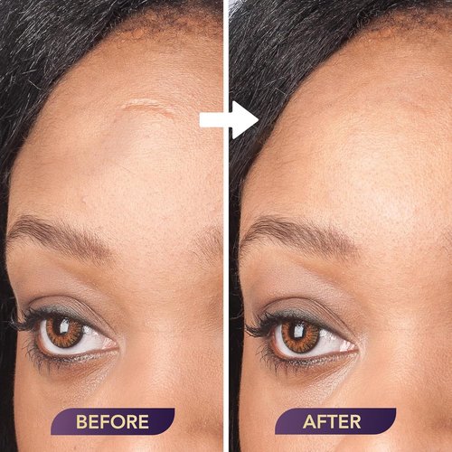 Dermaflage Extended Wear Primer - Perfect Base for Dermaflage Topical Filler | Long-Lasting Formula