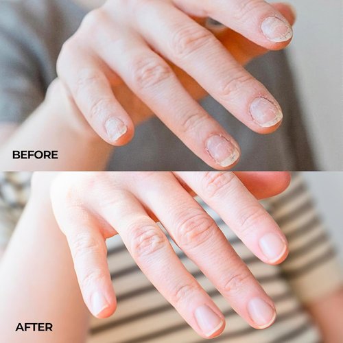 NakeyNails Fast-Absorbing Nail Strengthener | Revitalize Weak, Thin & Post-Acrylic Nails - 45 Day Supply