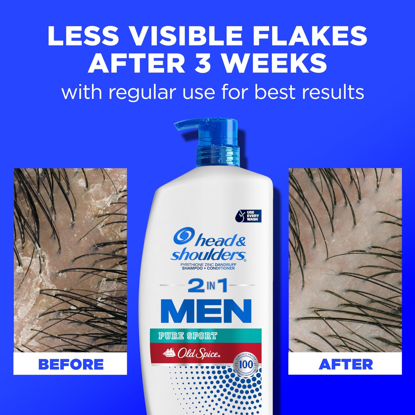 Head & Shoulders 2-in-1 Dandruff Shampoo and Conditioner Set, Clinically Proven Dandruff & Itch Relief, Lemon-Lime Scent of Old Spice Pure Sport, Nourish Scalp & Hair, 31.4 Fl Oz Each, 2 Pack