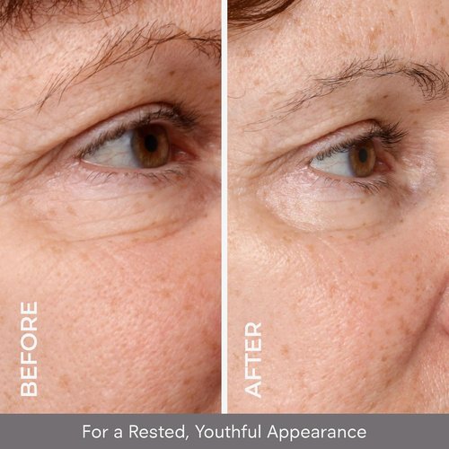 COSMEDIX Under Eye Serum - Brightening & Hydrating Formula for Dark Circles & Puffiness | Lifting Liquid for Fine Lines