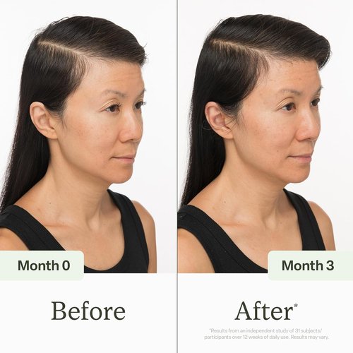 Divi Scalp Serum - Non-Greasy Formula with Amino Acids & Caffeine | Promotes Healthy Scalp & Fuller Hair