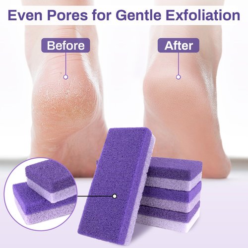 RAQEHO 10 Pumice Stone for Feet - 4.7 x 2 x 1 Inch Double Side Purple Foot Pumice Stone, Foot Filer Pedicura Scrubber for Callus Removal, Foot Care Spa Productos for Dark Elbows Hard Skin Exfoliating