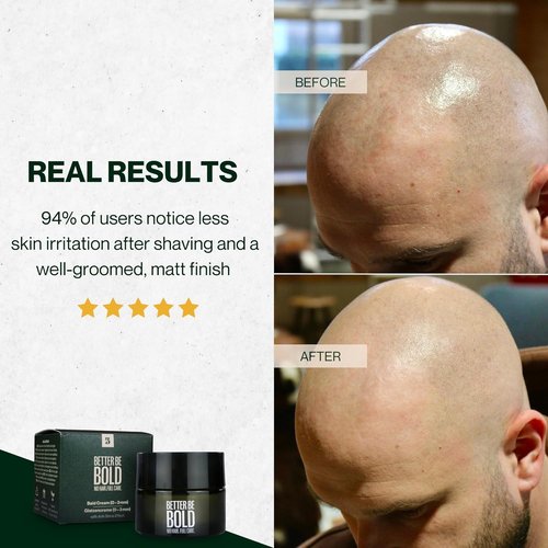 Regine Switzerland Nourishing Bald Cream - Quick Absorption, Matte Finish | 0-3 mm, Soothing Magnolia Extract
