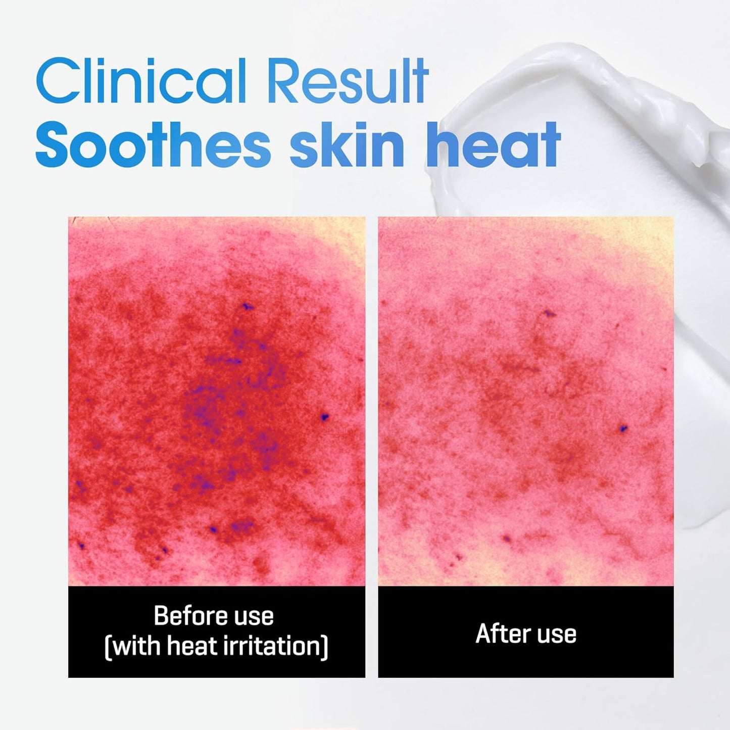 Some By Mi AHA BHA PHA 30 Days Miracle Acne Clear Body Cleanser | Beta-Panthenol Repair Cream