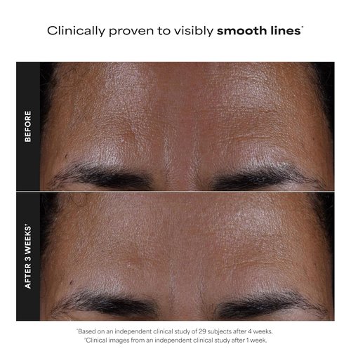 Paula's Choice SKIN PERFECTING 2% BHA Liquid Exfoliant - Salicylic Acid Facial Polish for Enlarged Pores & Fine Lines - Fragrance-Free