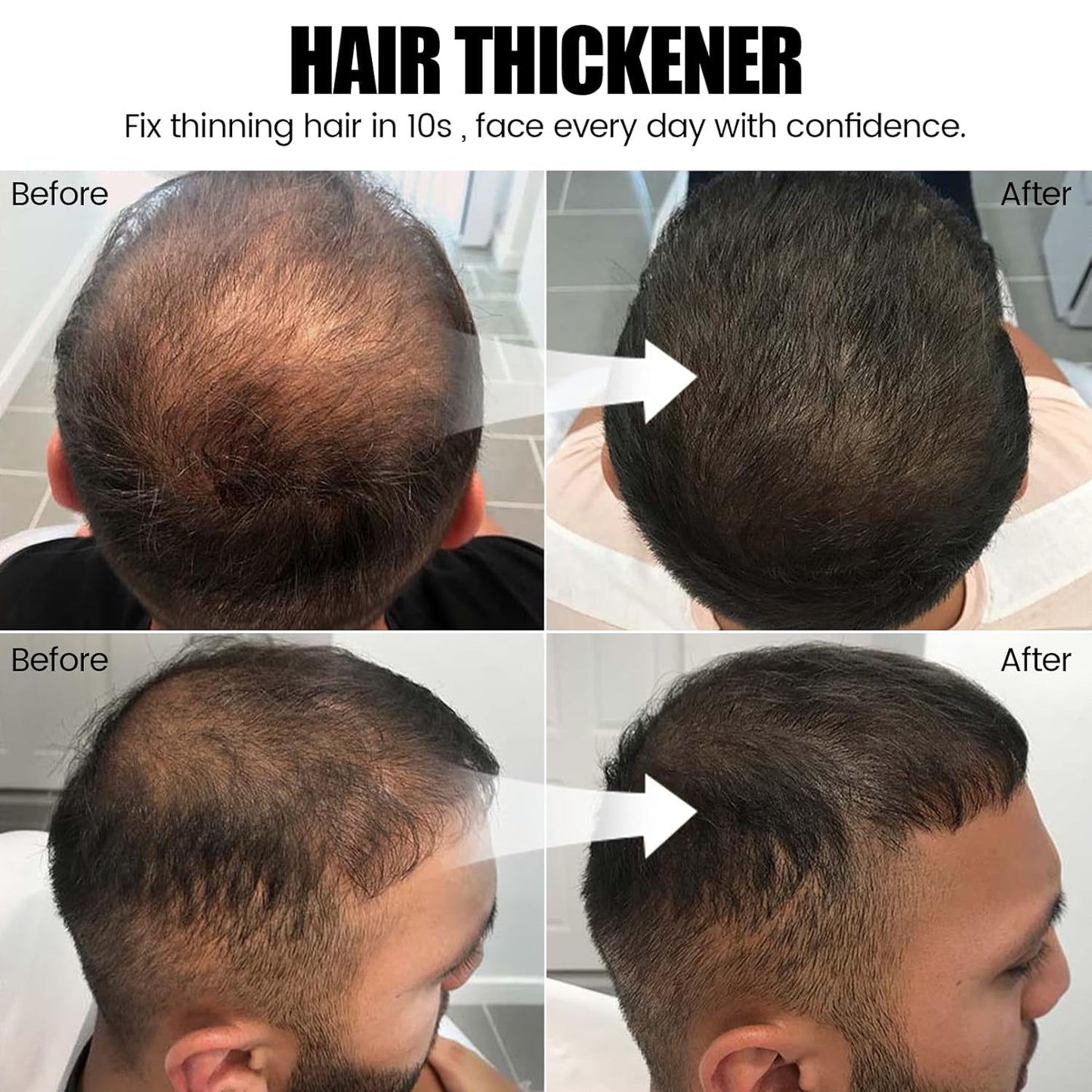 VOLLUCK Hair Thickening Fibers Spray - Temporary Dark Brown Root Concealer for Men & Women | Sweatproof Coverage
