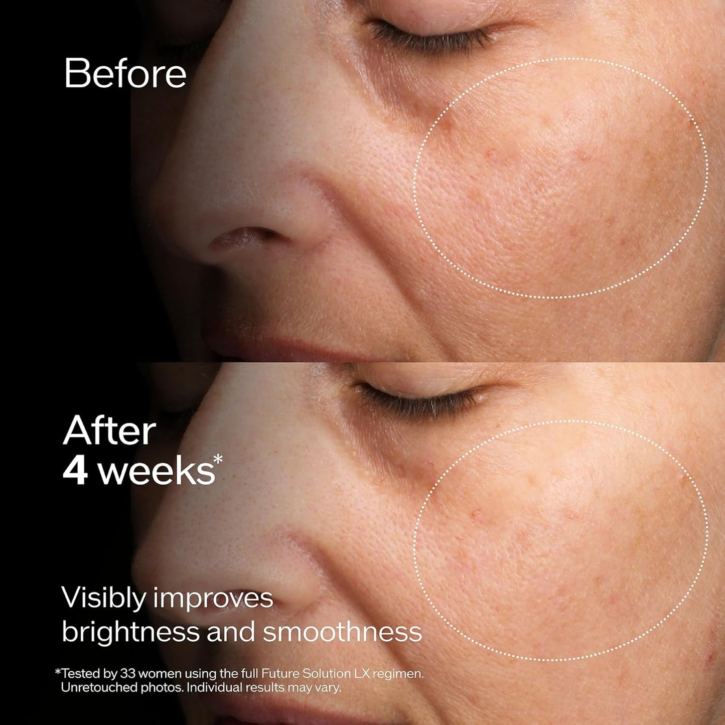 Shiseido Future Solution LX Brightening Softener - Anti-Aging Facial Lotion for All Skin Types - Smooths & Clarifies