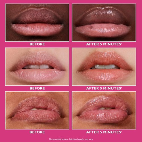 Peter Thomas Roth | Instant FIRMx® Lip Filler - Plumping Treatment for Enhanced Volume & Smooth Lip Lines