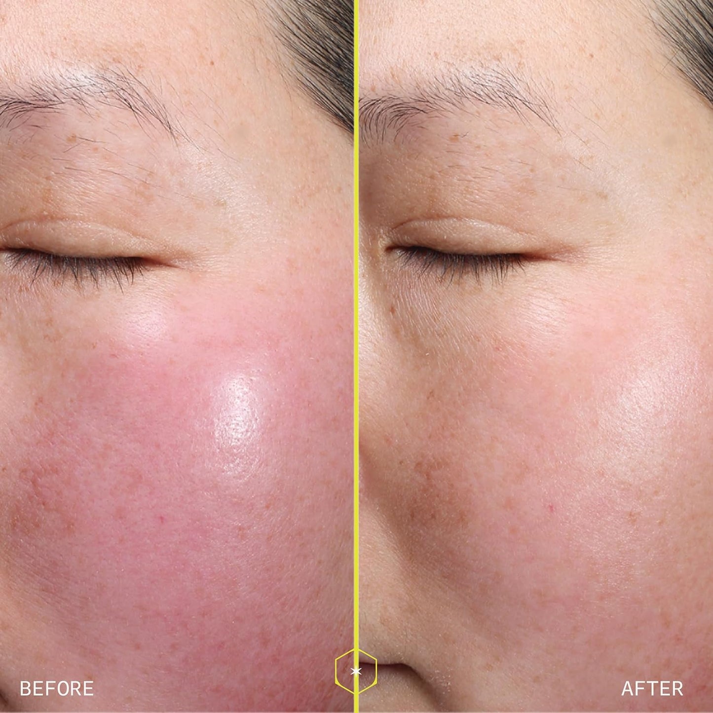 Skiennix 1% Retinol Peptide Boosting Serum - Reduces Wrinkles & Discoloration - 30ml with Collagen Peptides