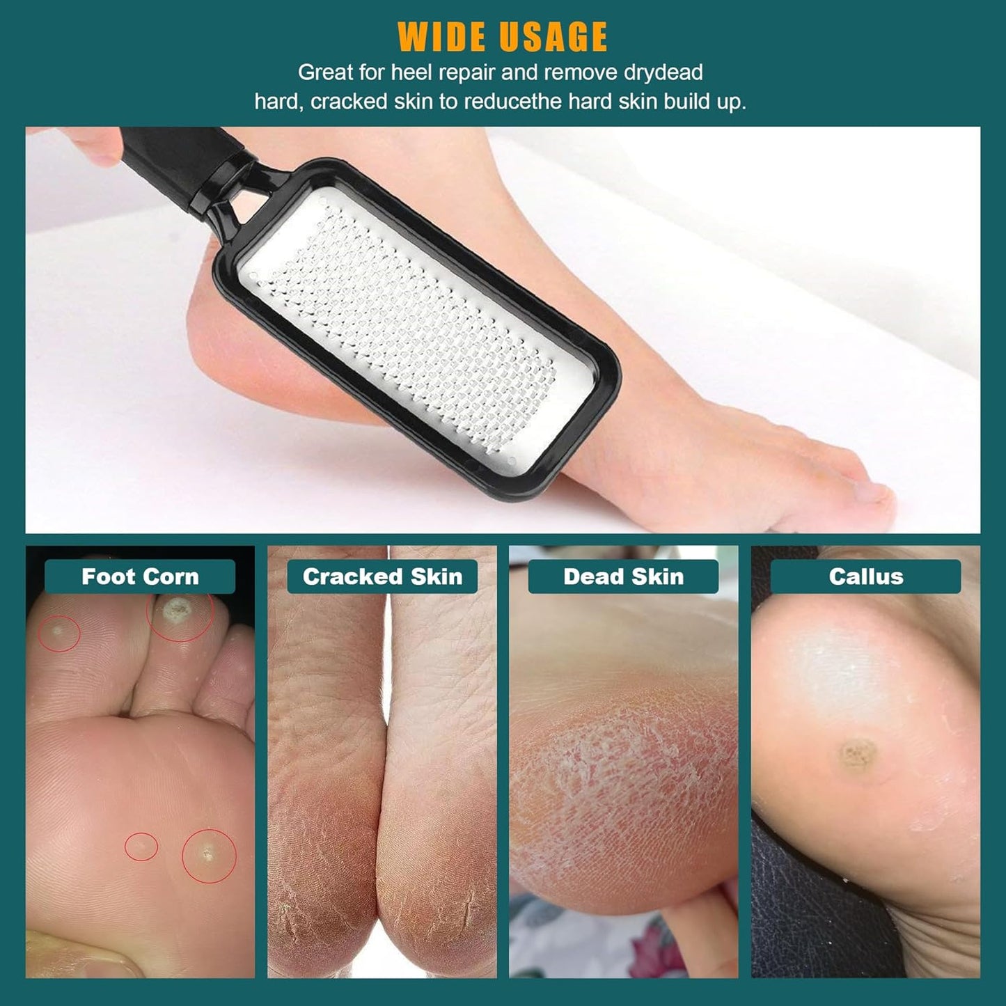 Skiennix Foot Rasp - Stainless Steel Pedicure Callus Remover | 2 Pcs for Professional Foot Care