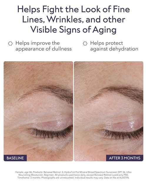 ALASTIN Skincare Renewal Retinol Serum - Visibly Improve Skin Texture & Tone | Reduce Fine Lines & Wrinkles