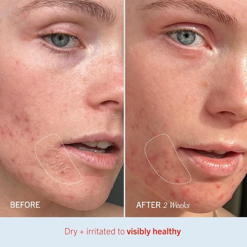 First Aid Beauty - Ultra Repair Cream | Intense Hydration with Whipped Oatmeal, 2 oz, 3 ct - Relieves Eczema