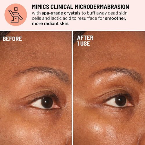 Dr. Brandt Advanced Microdermabrasion Face Exfoliator - Refines Texture & Minimizes Fine Lines - 2 oz