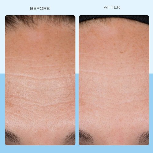 First Aid Beauty - Firming Collagen Cream | Ultra-Rich Moisturizer with Peptides & Niacinamide, 3.5 oz