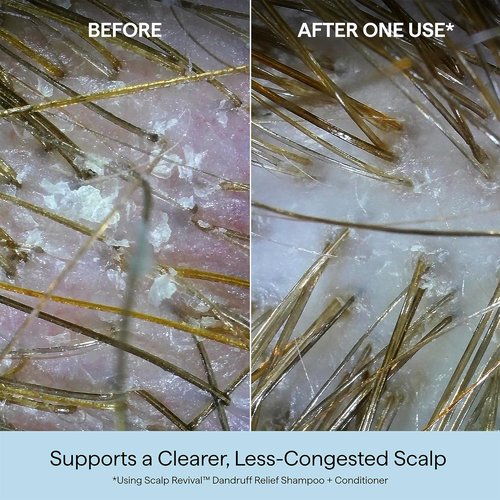 Briogeo Scalp Revival Shampoo & Conditioner Bundle - Anti-Dandruff Care with Charcoal & Salicylic Acid | 2 x 8.4 fl oz