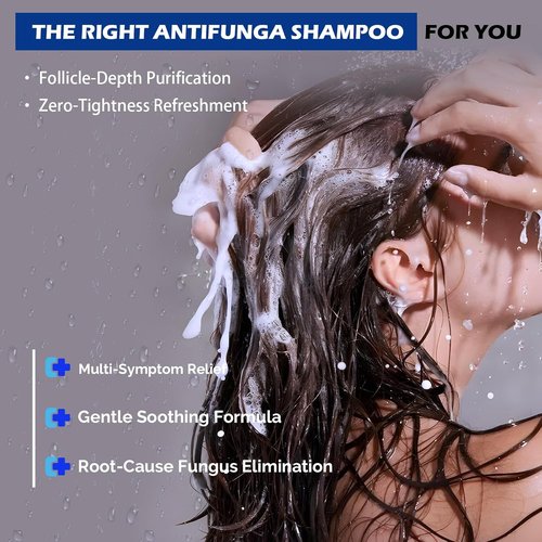 Regine Switzerland Antifungal Psoriasis Shampoo - Relieves Scalp Itching & Dryness | 10.1 Fl Oz