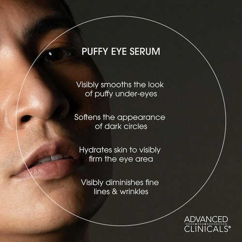 Advanced Clinicals Under Eye Serum - Anti-Aging Vitamin C & Caffeine for Puffiness, Dark Circles | 1.75 Fl Oz