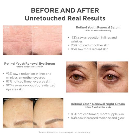Murad Active Renewal Regimen Kit | 5-Piece Trial Set for Youthful Skin - $98 Value