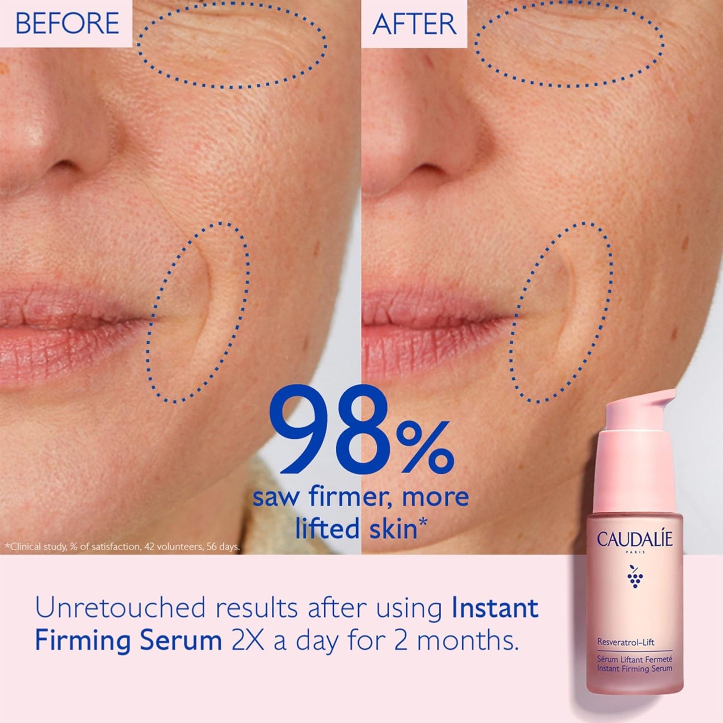 Caudalie Resveratrol-Lift Serum - Instant Firming Retinol Alternative, Refillable 30 mL