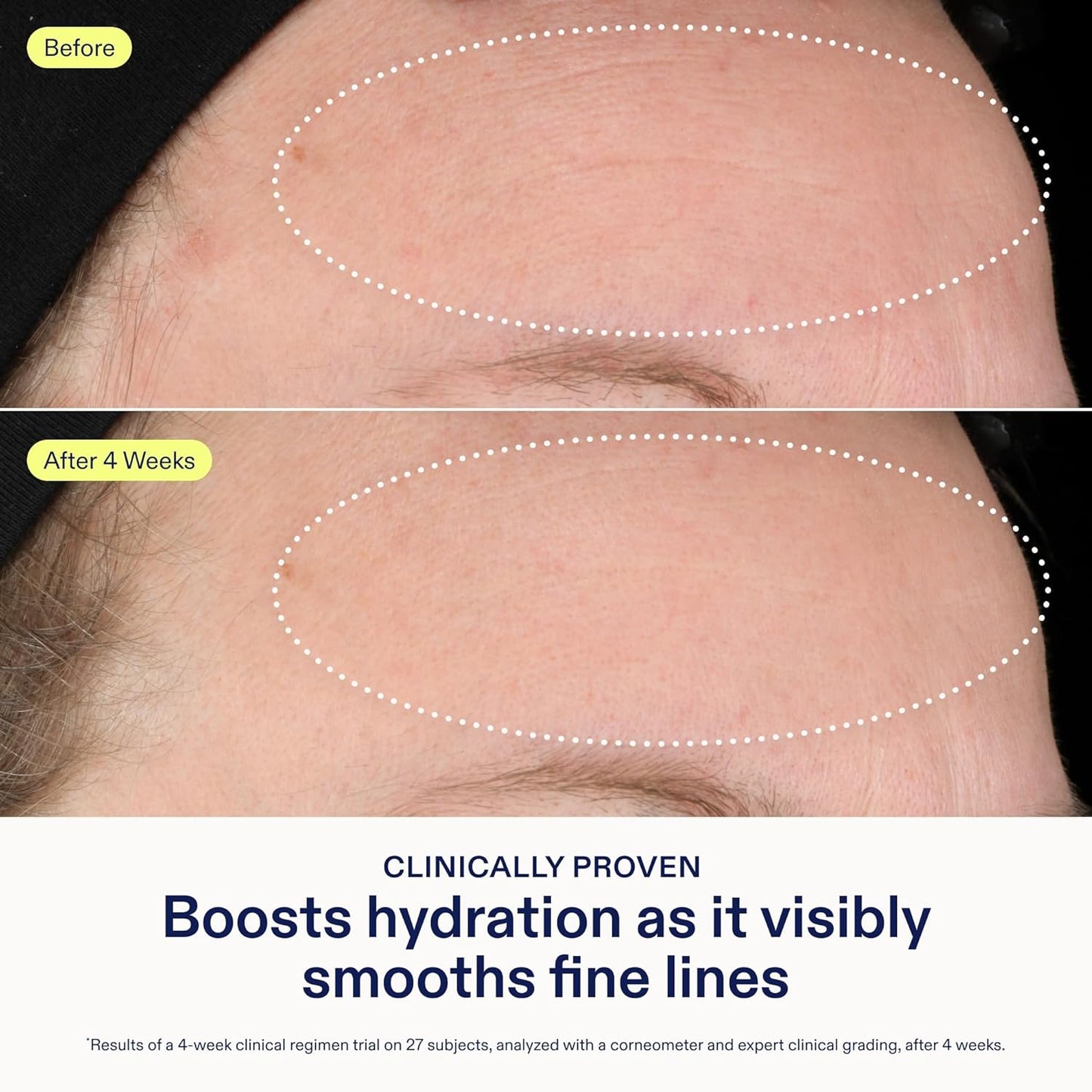 Skinfix Triple Lipid-Hyaluronate Serum - Hydrating Face Serum for Lasting Moisture - 1 oz | Smooths Fine Lines, Vegan & Cruelty-Free