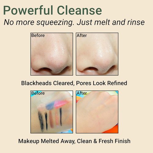CELDYQUE Pore Purifying Cleansing Oil - Gentle Korean Face Wash with Centella & Tea Tree for Acne-Prone Skin, 6.76 fl oz