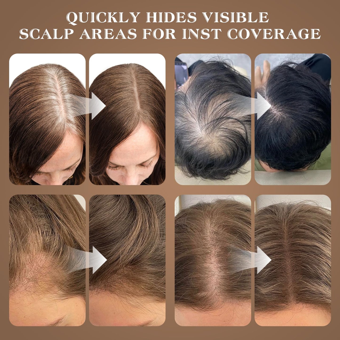 Yargkos Hairline Shadow Powder, Auburn, Root Touch Up Powder for Instantly Gray Hair Cover Up, Women Color Root Coverage for Thinning Grey, Mens Roots Concealer for Hair Loss Beard Line, #9