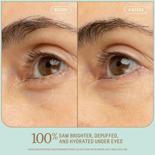 Biossance Squalane Eye Serum | Brightening & Depuffing Treatment for Dark Circles – Vitamin C & Caffeine Formula – Stainless Steel Rollerball