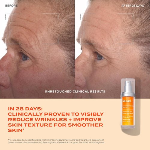 Murad Rapid Dark Spot Correcting Serum - Advanced Anti-Aging Formula with Resorcinol & Glycolic Acids - 1 Fl Oz