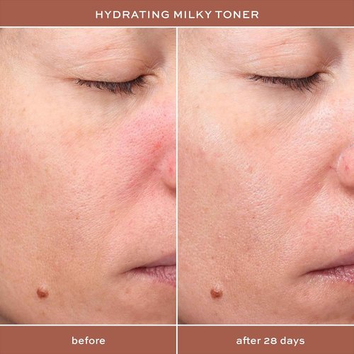 ITK Hydrating Milky Face Toner - Hyaluronic Acid & Green Tea for Dry Skin Relief | 5 oz. Vegan Formula