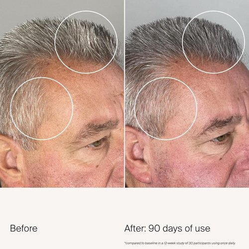 Living Proof Scalp Care Density Serum - Boost Hair Thickness & Volume | 2 oz