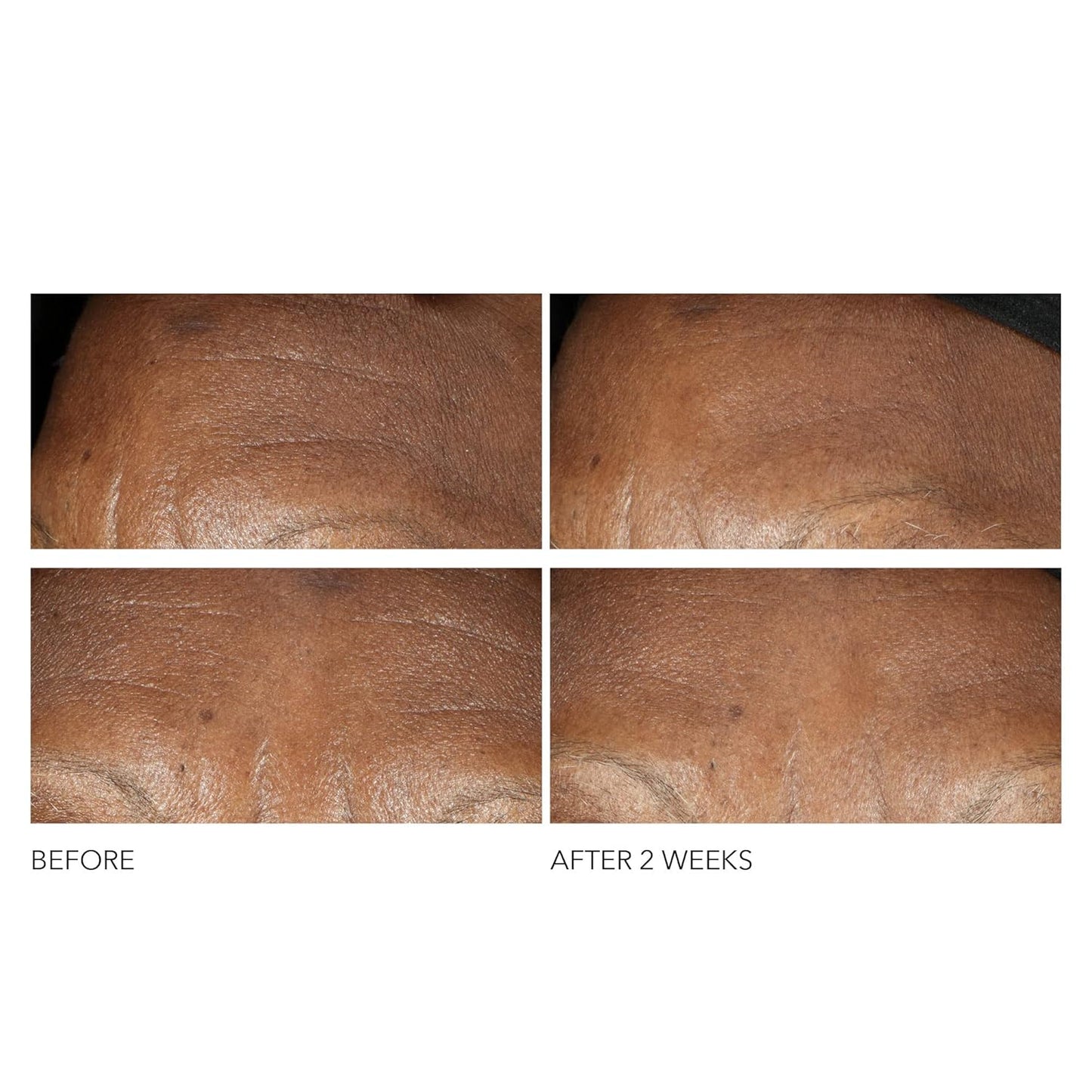 Dr. Dennis Gross Advanced Retinol + Ferulic Wrinkle Cream - Intensely Hydrating Skin Repair | 2 oz