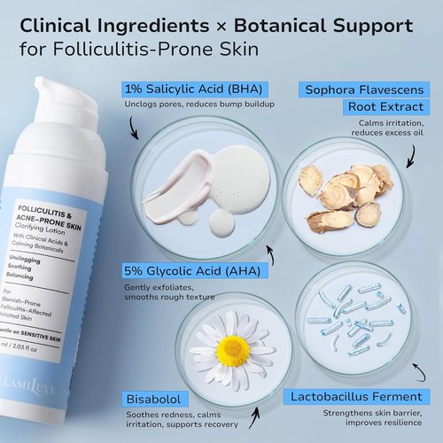 BellamiLuxx Folliculitis Acne Lotion - Reduces Itch, Redness & Body Acne with Salicylic Acid | Gentle Care for Sensitive Skin