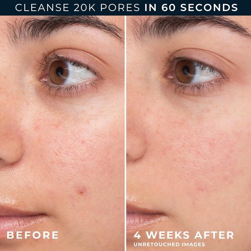 RoC Barrier Renew Gel-To-Foam Facial Cleanser - Hydrating Formula for Sensitive Skin | 12 Ounces