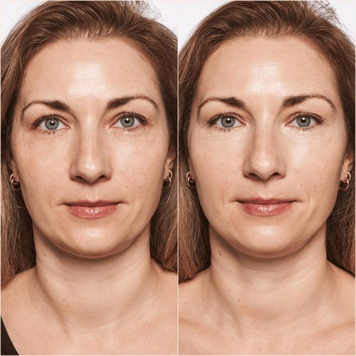Catrice | True Skin High Cover Concealer (002 | Neutral Ivory) | Waterproof & Lightweight for Soft Matte Look | With Hyaluronic Acid & Lasts Up to 18 Hours | Vegan, Cruelty Free