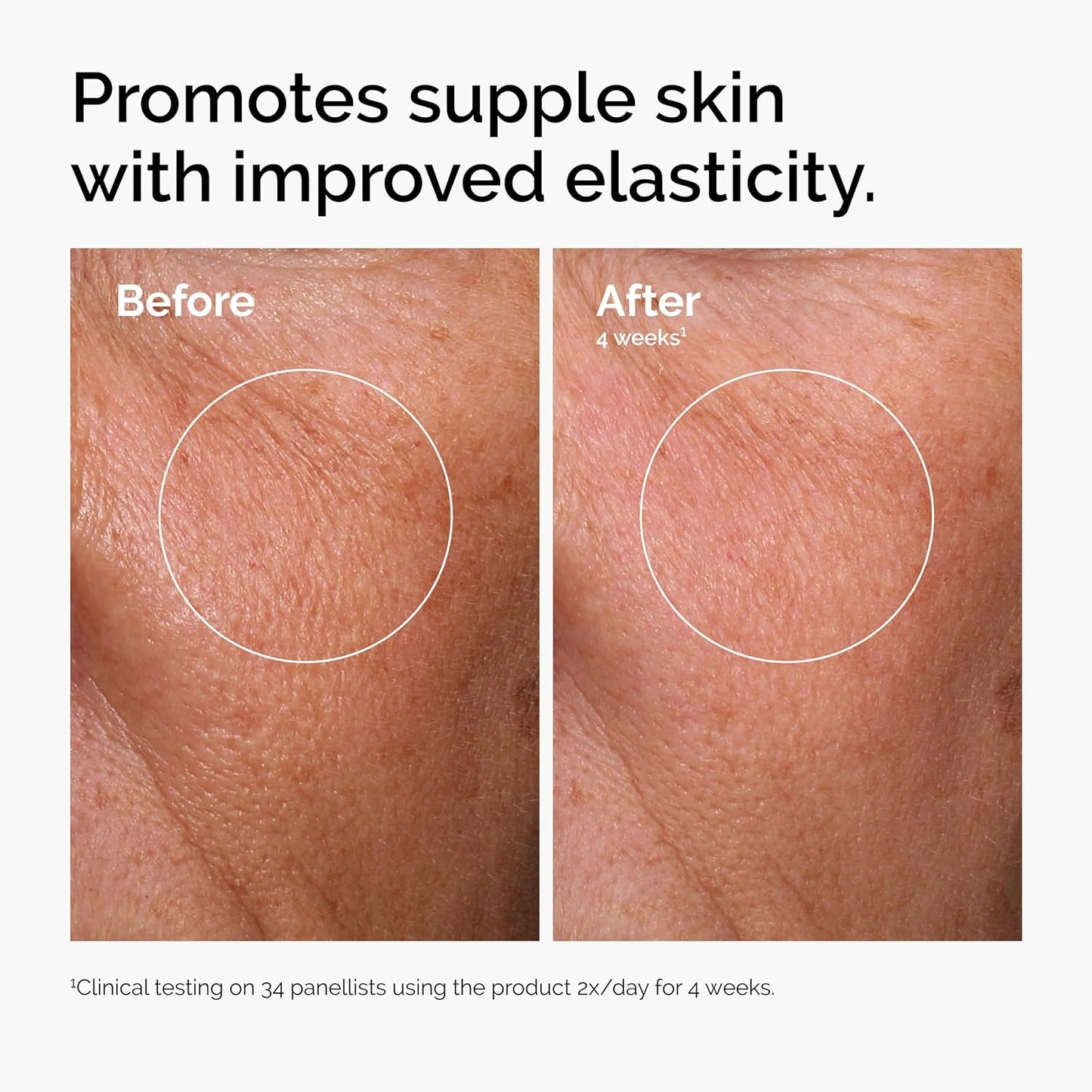 The Ordinary Hyaluronic Acid 2% + B5 Serum - Multi-Depth Hydration for Plumper, Smoother Skin