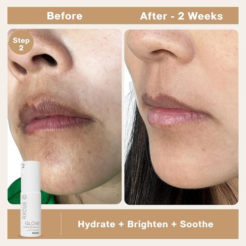 Rxcue Korean Skincare Set - 3-Step K-Beauty Kit for Glass Skin | TSA Approved Travel Size, 1.01 fl oz Each