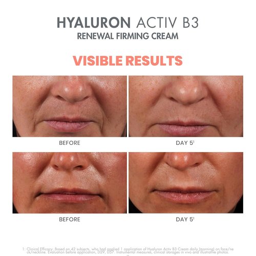 Avène Hyaluron Activ B3 Firming Cream - Hydrating Anti-Aging Formula for Youthful Skin