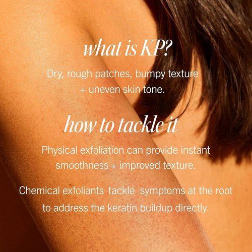 First Aid Beauty - KP Bump Eraser Body Scrub | 10% AHA Exfoliator for Keratosis Pilaris, Peach Scent (8 oz)